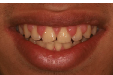 电刀怎么洗我以为只要洗个牙，医生你怎么还拿起了手术刀？_https://www.jmylbn.com_新闻资讯_第4张