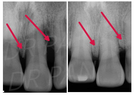 电刀怎么洗我以为只要洗个牙，医生你怎么还拿起了手术刀？_https://www.jmylbn.com_新闻资讯_第8张