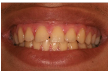 电刀怎么洗我以为只要洗个牙，医生你怎么还拿起了手术刀？_https://www.jmylbn.com_新闻资讯_第5张