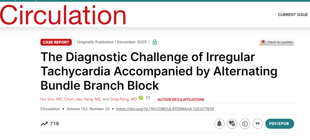 心电图机通道怎么分类阜外医院窦克非团队完成多通道“全程辅助”血管介入手术机器人PCI手术 ｜ 西安市中心医院破解罕见心电图诊断难题_https://www.jmylbn.com_新闻资讯_第5张