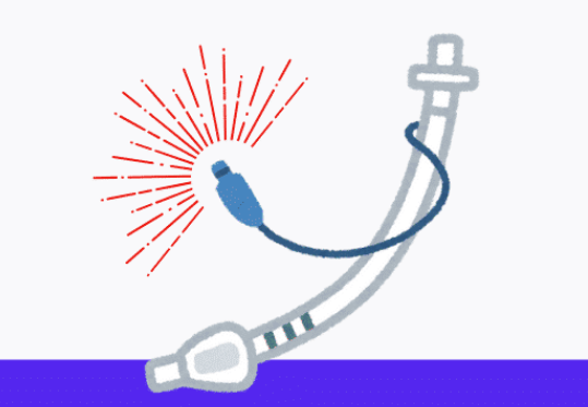 呼吸机f什么意思呼吸机模式，不要搞得这么复杂！_https://www.jmylbn.com_新闻资讯_第7张