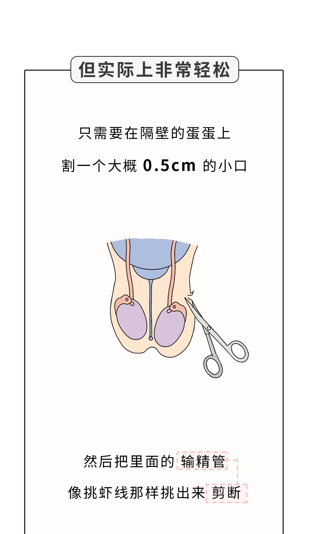 你願意為女朋友做結紮手術嗎？？？ 情感 第14張