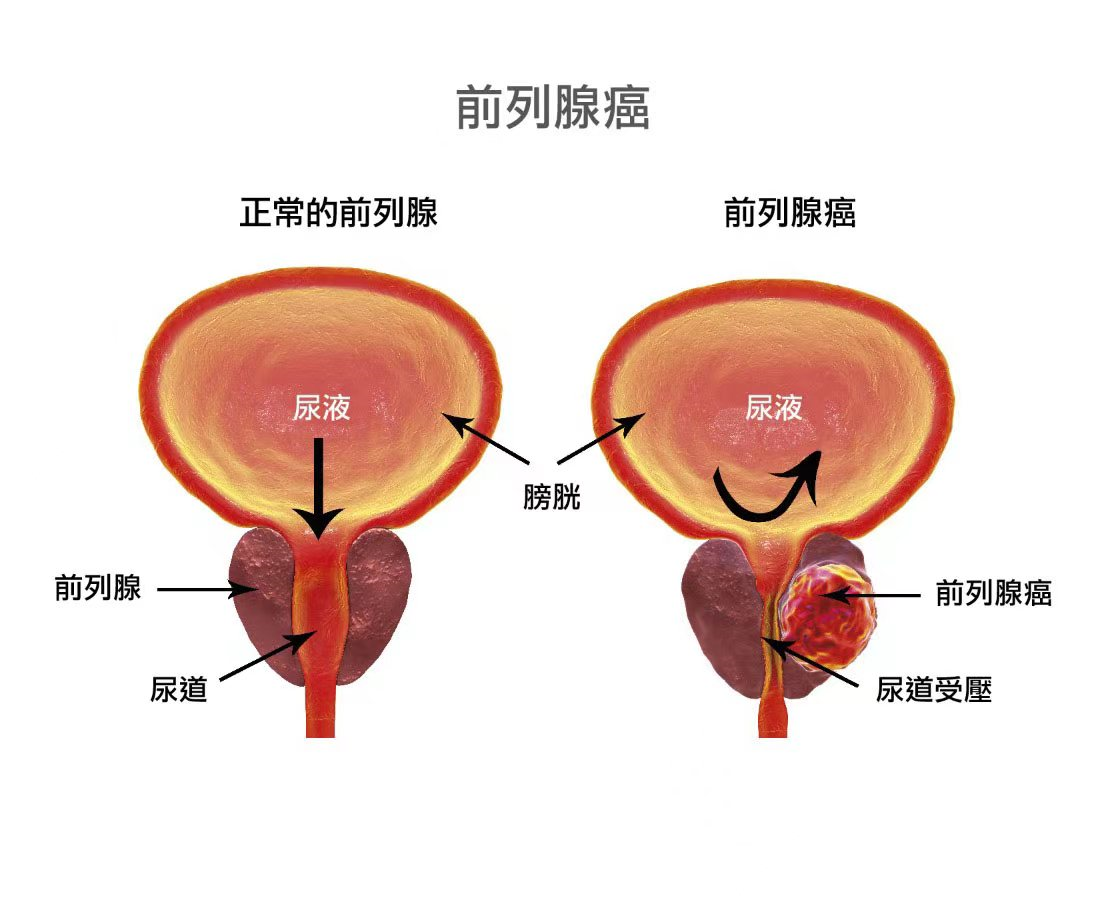 一个月做多少次爱正常