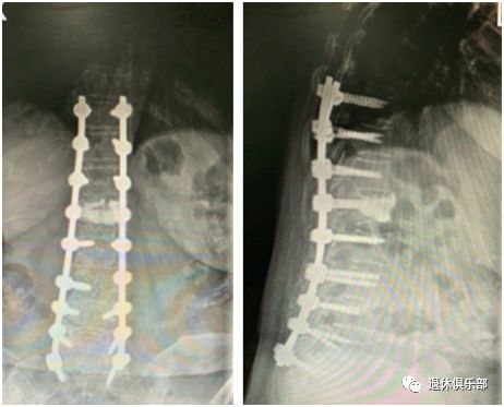 



驼背、高低肩、歪脖子…体态越来越丑，原来是这里弯了！
