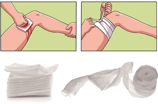 动脉什么压迫止血【健康科普】应对创伤，必学的止血法_https://www.jmylbn.com_新闻资讯_第13张