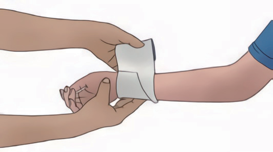 动脉什么压迫止血【健康科普】应对创伤，必学的止血法_https://www.jmylbn.com_新闻资讯_第16张