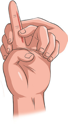 动脉什么压迫止血【健康科普】应对创伤，必学的止血法_https://www.jmylbn.com_新闻资讯_第6张