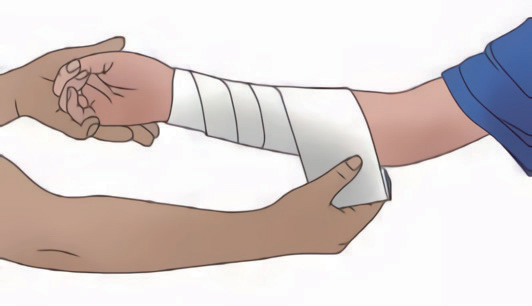 动脉什么压迫止血【健康科普】应对创伤，必学的止血法_https://www.jmylbn.com_新闻资讯_第17张