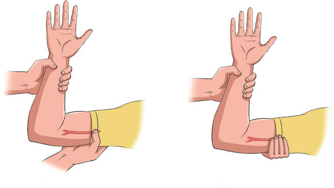 动脉什么压迫止血【健康科普】应对创伤，必学的止血法_https://www.jmylbn.com_新闻资讯_第5张