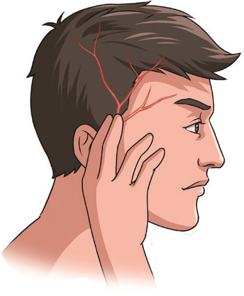 动脉什么压迫止血【健康科普】应对创伤，必学的止血法_https://www.jmylbn.com_新闻资讯_第4张