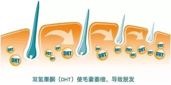 理清毛囊问题，才是治疗脱发的关键！