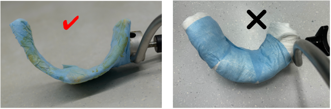 【滑动垫片单髁置换技术精讲系列】第一讲：麻醉、体位