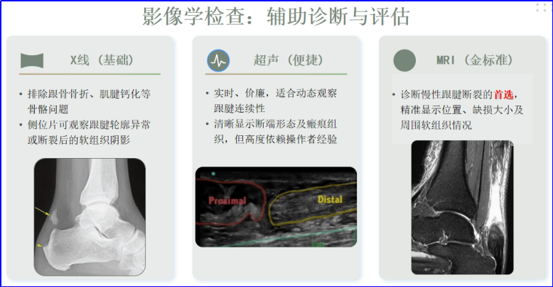 ​图文并茂：慢性跟腱断裂的最新治疗进展
