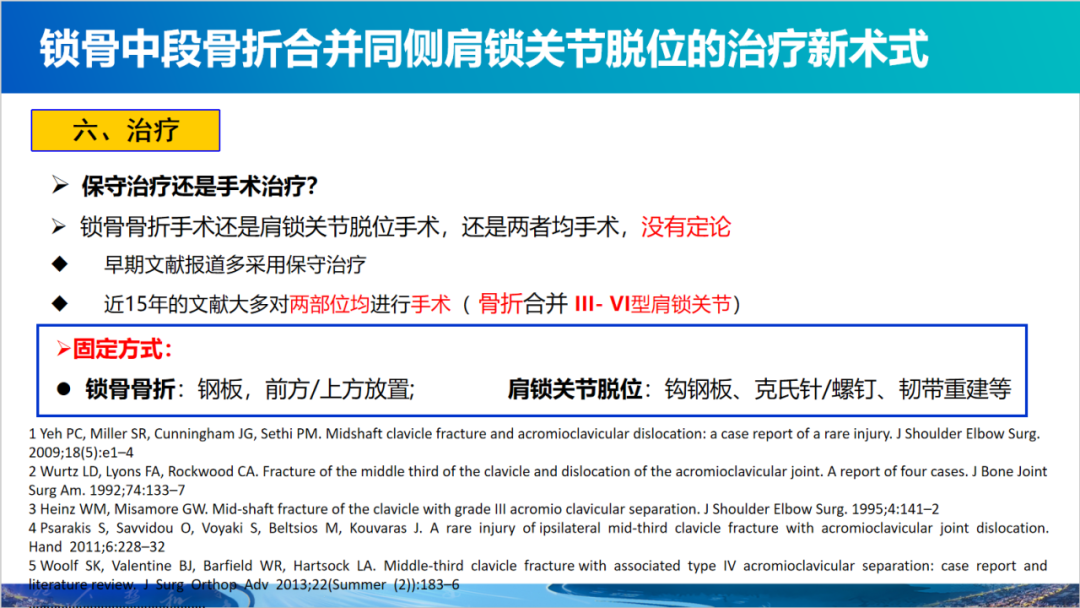锁骨中段骨折合并同侧肩锁关节脱位新术式：弹性髓内钉+喙锁韧带重建、关节囊缝合