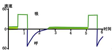 呼吸机f指什么常见呼吸机波形！_https://www.jmylbn.com_新闻资讯_第11张