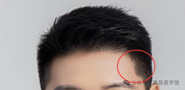 发际线的秘密：从美人尖到M型额，看穿你的命运走向