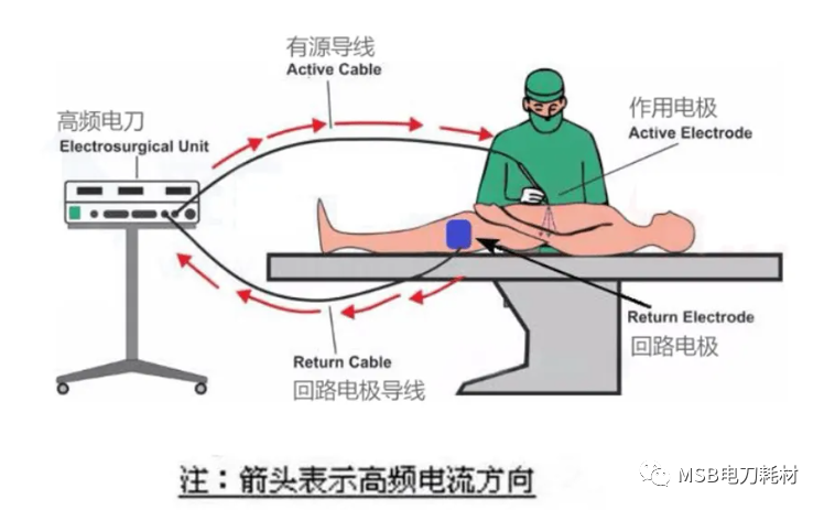 手术电刀什么电源高频电刀的分类及如何选择-上海聚慕医疗器械有限公司