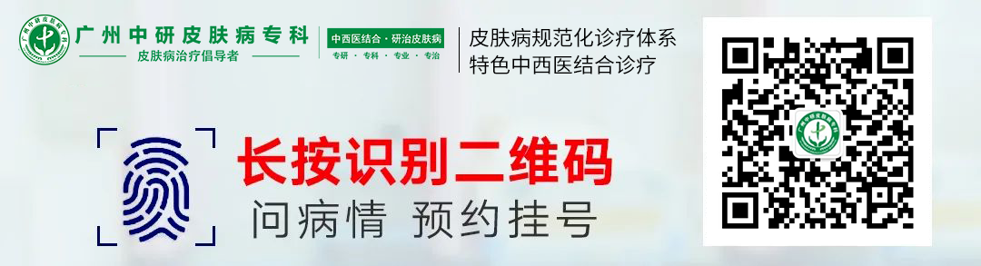 看脱发应该去医院挂什么科？脱发怎么治疗好？