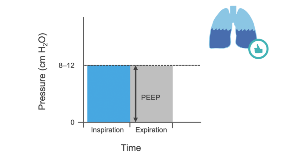 压力滴定怎么做做好这五点，缓解人机对抗_https://www.jmylbn.com_新闻资讯_第5张