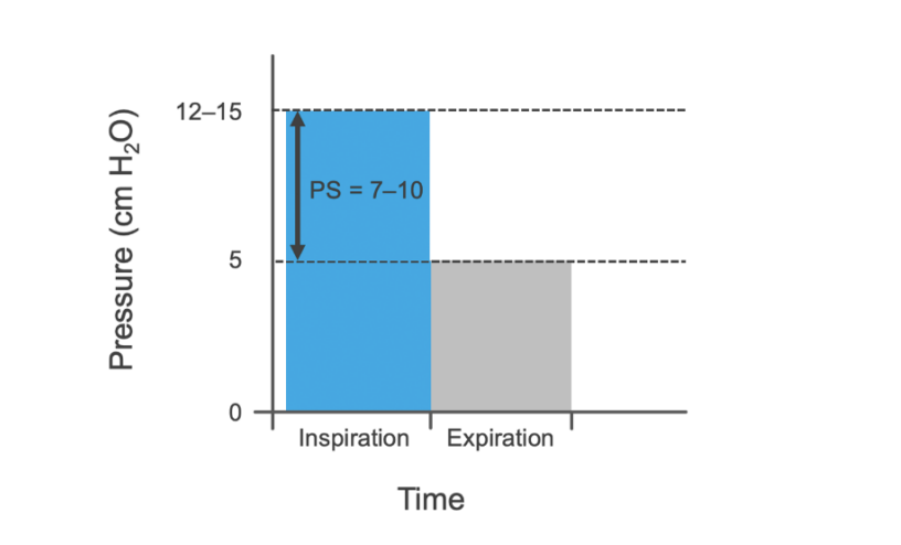 压力滴定怎么做做好这五点，缓解人机对抗_https://www.jmylbn.com_新闻资讯_第3张