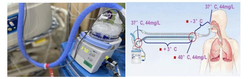 湿化液是什么常用气道湿化方式及湿化液_https://www.jmylbn.com_新闻资讯_第8张