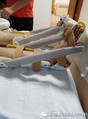 下肢关节康复器怎么用康复路上的好帮手：矫形器_https://www.jmylbn.com_新闻资讯_第17张