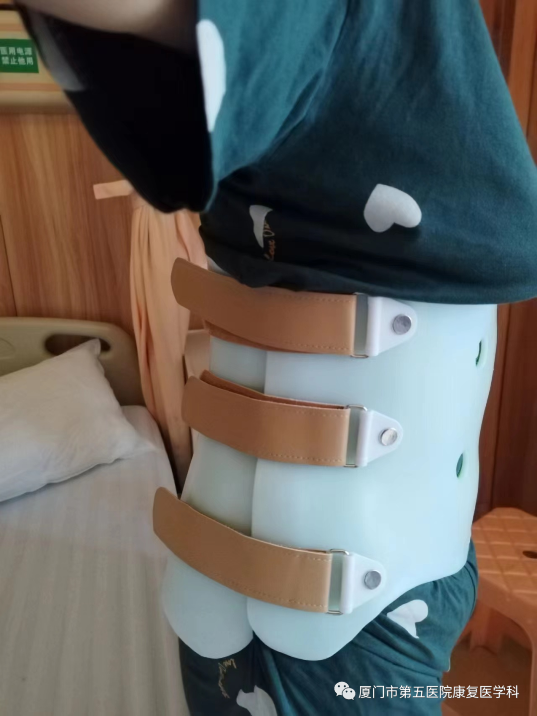下肢关节康复器怎么用康复路上的好帮手：矫形器_https://www.jmylbn.com_新闻资讯_第35张