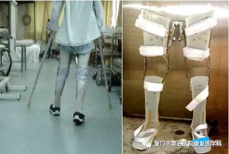 下肢关节康复器怎么用康复路上的好帮手：矫形器_https://www.jmylbn.com_新闻资讯_第13张