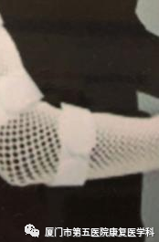 下肢关节康复器怎么用康复路上的好帮手：矫形器_https://www.jmylbn.com_新闻资讯_第2张