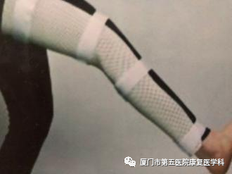 下肢关节康复器怎么用康复路上的好帮手：矫形器_https://www.jmylbn.com_新闻资讯_第9张