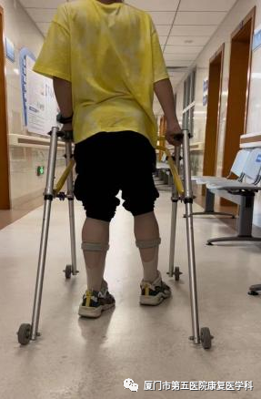 下肢关节康复器怎么用康复路上的好帮手：矫形器_https://www.jmylbn.com_新闻资讯_第14张