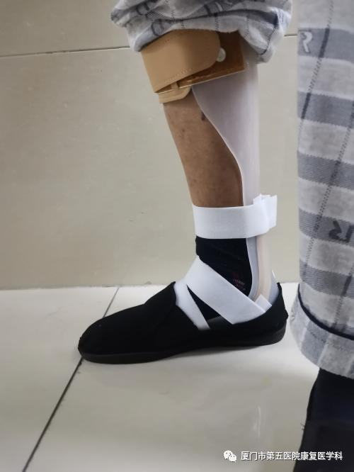下肢关节康复器怎么用康复路上的好帮手：矫形器_https://www.jmylbn.com_新闻资讯_第34张