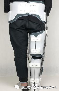 下肢关节康复器怎么用康复路上的好帮手：矫形器_https://www.jmylbn.com_新闻资讯_第8张