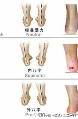 下肢关节康复器怎么用康复路上的好帮手：矫形器_https://www.jmylbn.com_新闻资讯_第19张