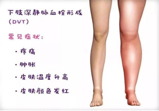 什么是压力治疗【压力治疗·上篇】原来压力治疗技术是这样的！_https://www.jmylbn.com_新闻资讯_第3张