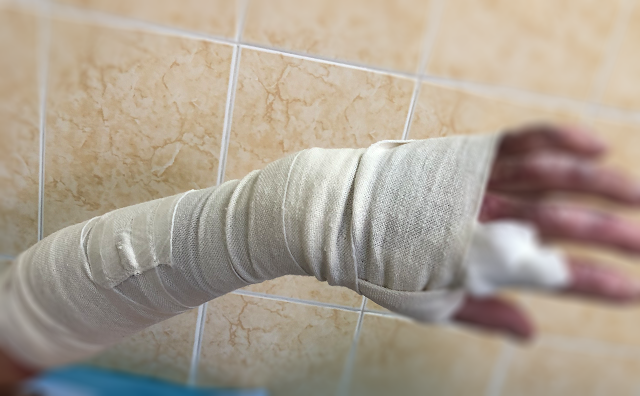 什么是压力治疗【压力治疗·上篇】原来压力治疗技术是这样的！_https://www.jmylbn.com_新闻资讯_第1张