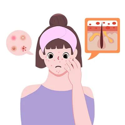 红蓝光治疗仪怎么使用皮肤科神器，痘痘杀手，神奇的“红蓝光”治疗仪_https://www.jmylbn.com_新闻资讯_第9张