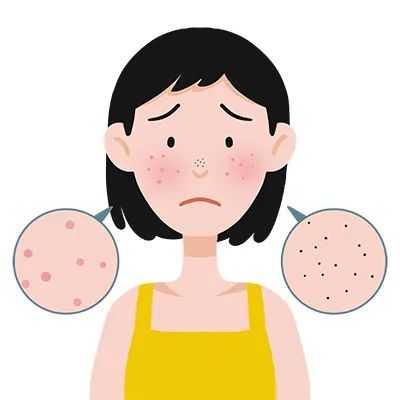 红蓝光治疗仪怎么使用皮肤科神器，痘痘杀手，神奇的“红蓝光”治疗仪_https://www.jmylbn.com_新闻资讯_第8张