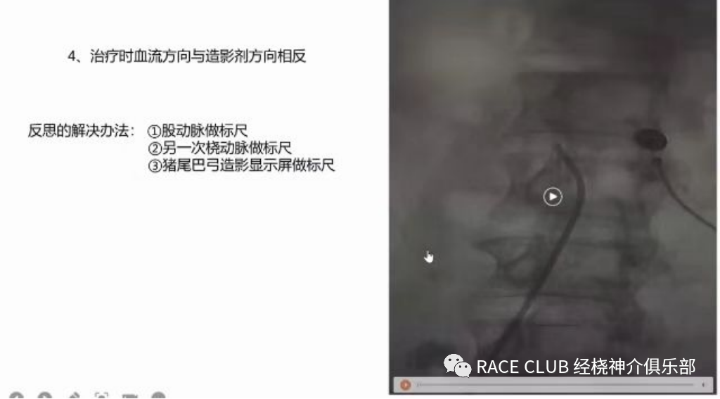 桡动脉鞘怎么读何爽教授：经桡动脉神经介入诊治的困难及并发症_https://www.jmylbn.com_新闻资讯_第18张
