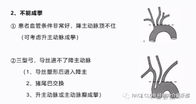 桡动脉鞘怎么读何爽教授：经桡动脉神经介入诊治的困难及并发症_https://www.jmylbn.com_新闻资讯_第9张