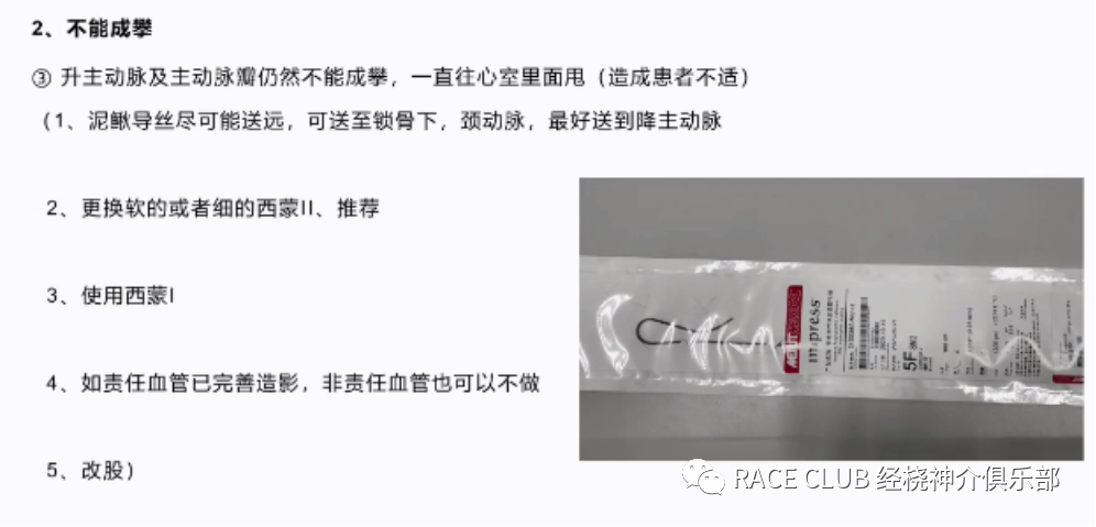 桡动脉鞘怎么读何爽教授：经桡动脉神经介入诊治的困难及并发症_https://www.jmylbn.com_新闻资讯_第10张