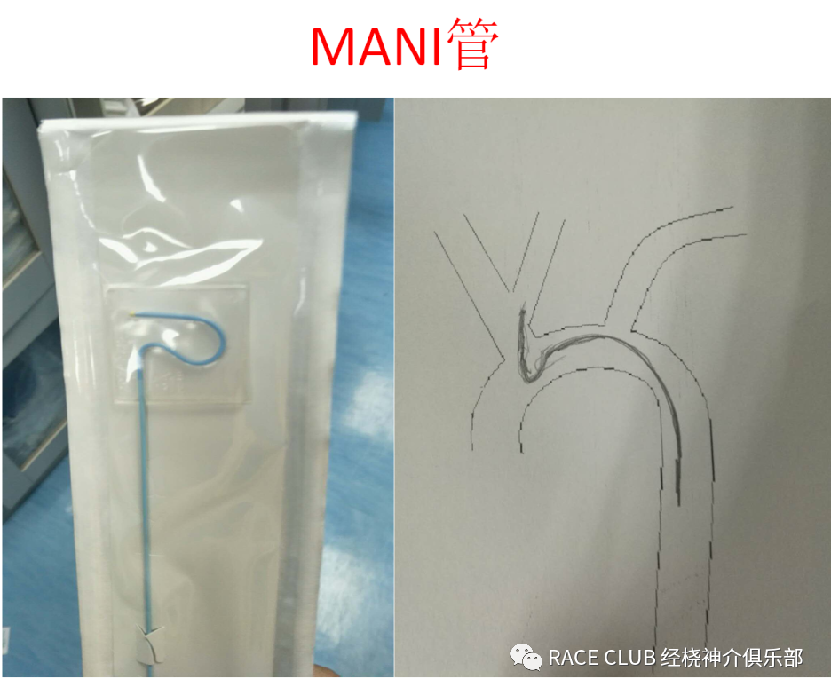 造影导丝是什么全脑血管造影术_https://www.jmylbn.com_新闻资讯_第19张