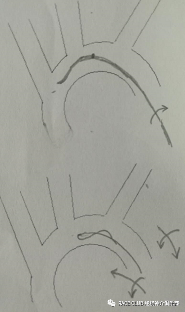 造影导丝是什么全脑血管造影术_https://www.jmylbn.com_新闻资讯_第22张