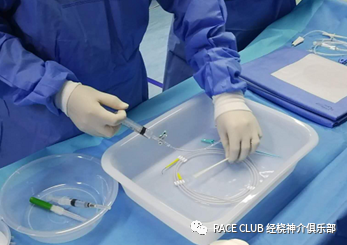 造影导丝是什么全脑血管造影术_https://www.jmylbn.com_新闻资讯_第5张