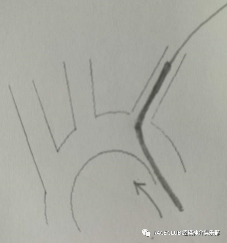 造影导丝是什么全脑血管造影术_https://www.jmylbn.com_新闻资讯_第20张