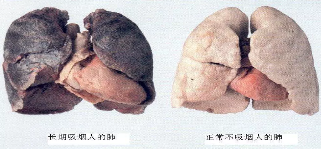 世界无烟日丨请听医生的话，爱护健康，远离烟草(图4)