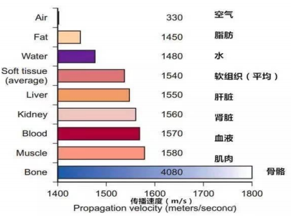 彩超伪像是什么声速失真伪像_https://www.jmylbn.com_新闻资讯_第5张