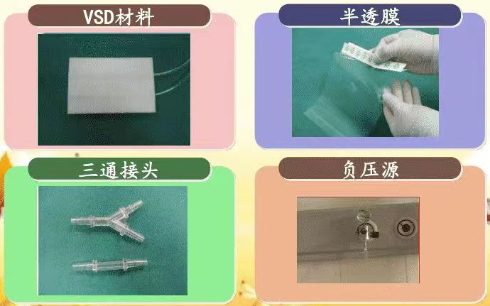 为什么负压引流何为负压封闭引流术？_https://www.jmylbn.com_新闻资讯_第3张