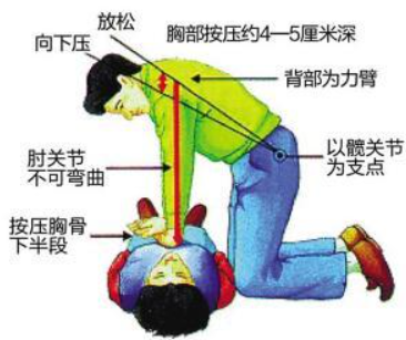 心肺复苏怎么数数字“1001，1002，1003……”是代表心肺复苏按压了1000多次吗？_https://www.jmylbn.com_新闻资讯_第8张