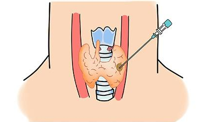 微波能治什么病微波消融术是一种什么手段，能治疗哪些疾病？_https://www.jmylbn.com_新闻资讯_第2张
